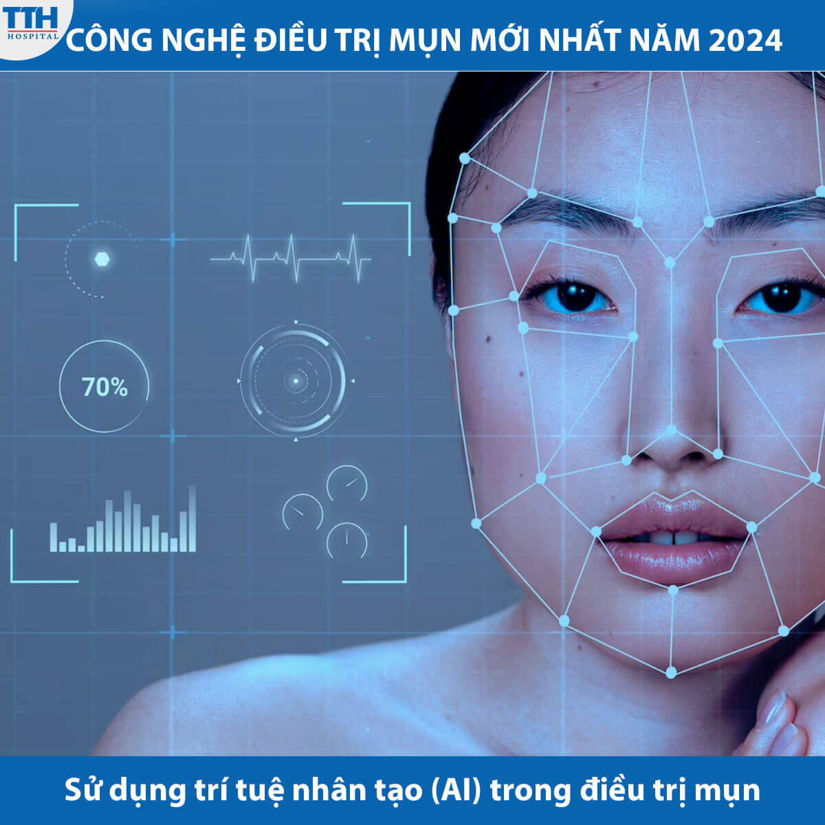Sử dụng trí tuệ nhân tạo (AI) trong điều trị mụn
