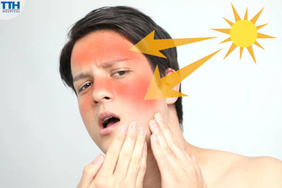 Tác Động Của Tia UV Gây Ra Vết Bớt trên Da