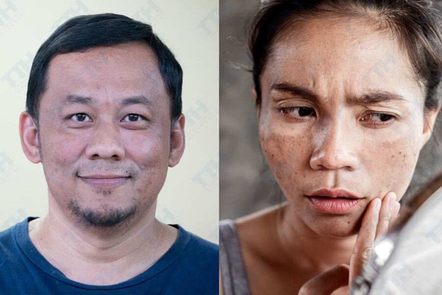 Tác động tâm lý và xã hội