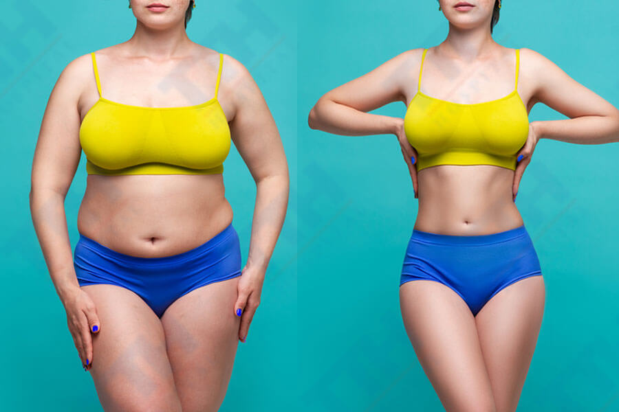 tạm biệt những vùng mỡ thừa khó chịu