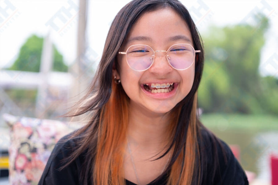 Tầm Quan Trọng của Việc Niềng Răng Đúng Thời Điểm