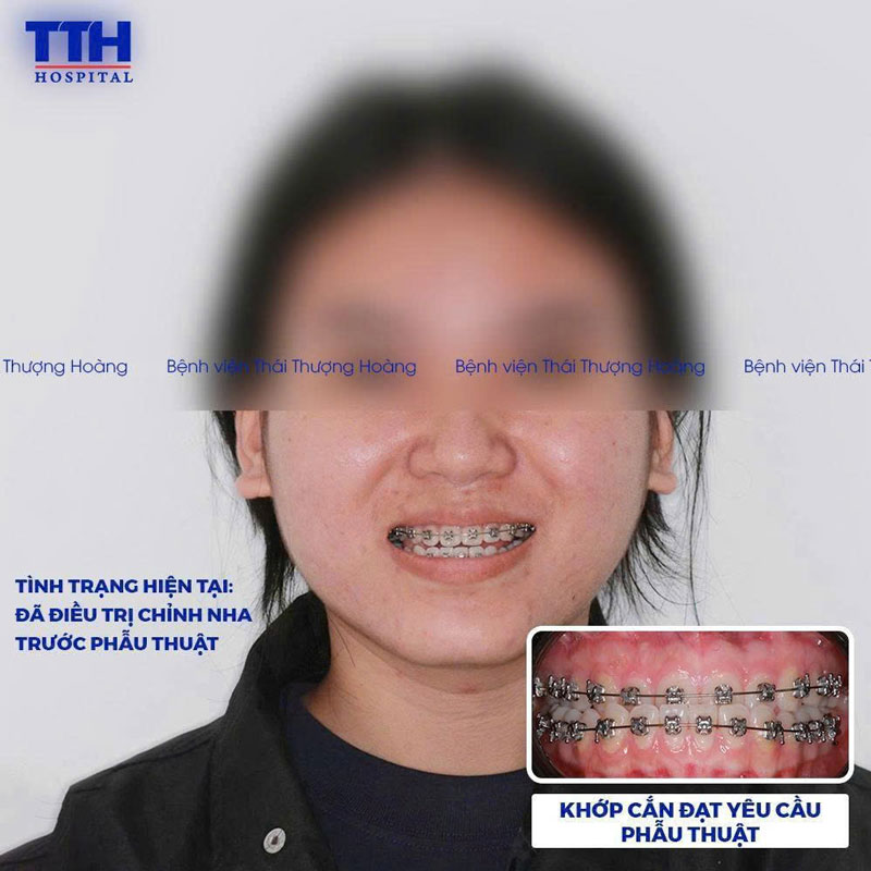 Tình trạng khách hàng