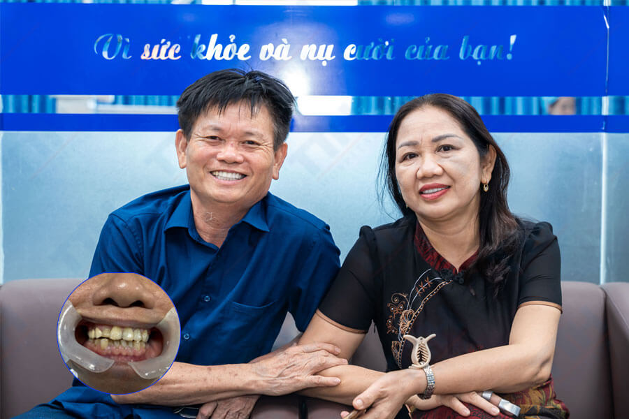 Chăm Sóc và Bảo Quản Răng Sứ Zirconia