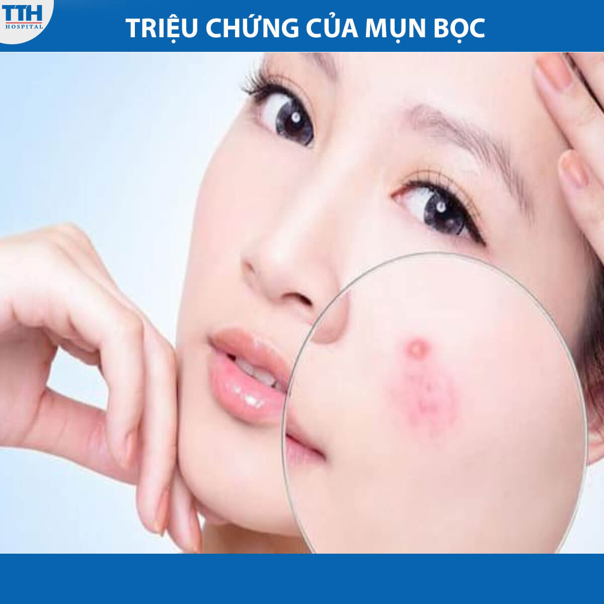 Triệu chứng của mụn bọc