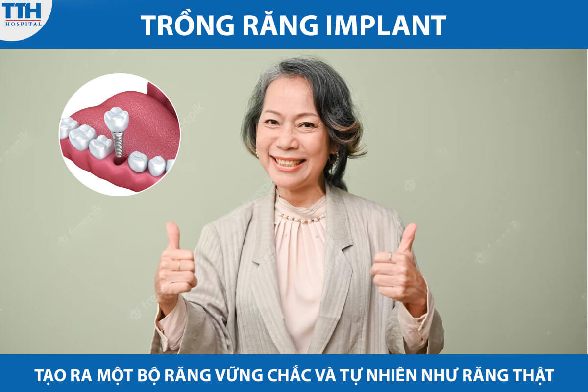 Ưu điểm của răng Implant