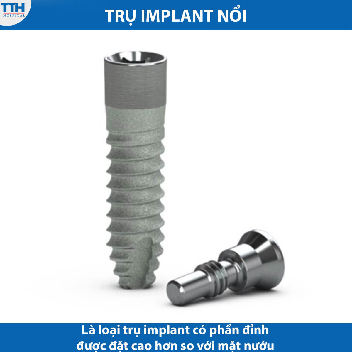 Trụ implant nổi