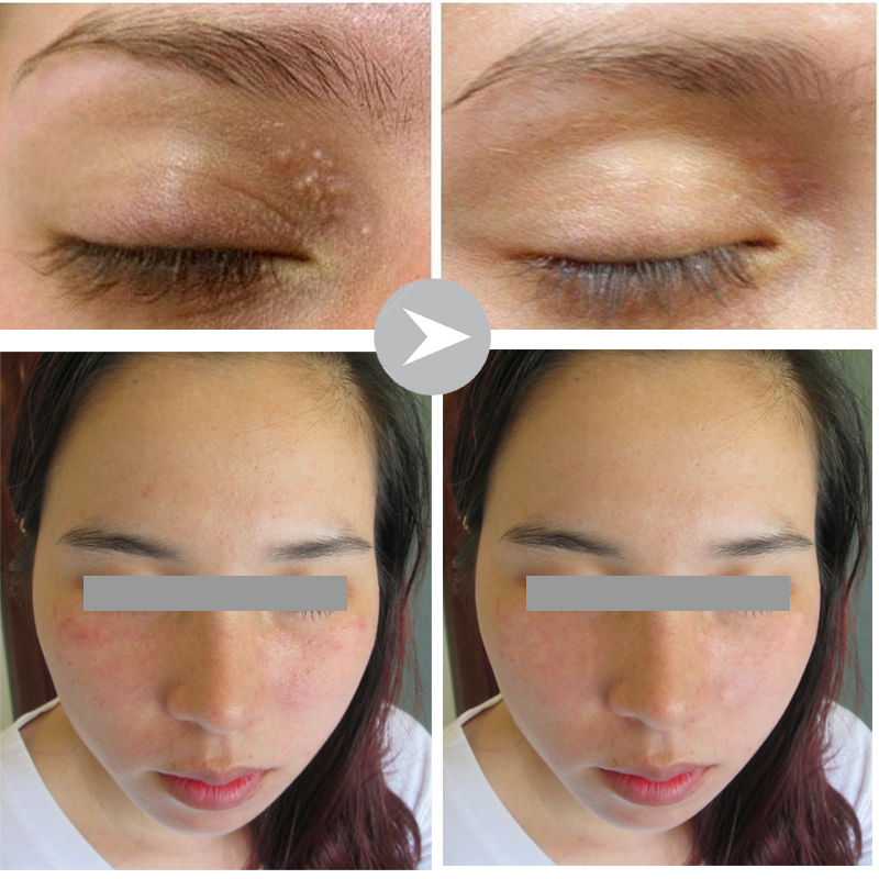 HÌNH ẢNH TRƯỚC VÀ SAU KHI THỰC HIỆN 