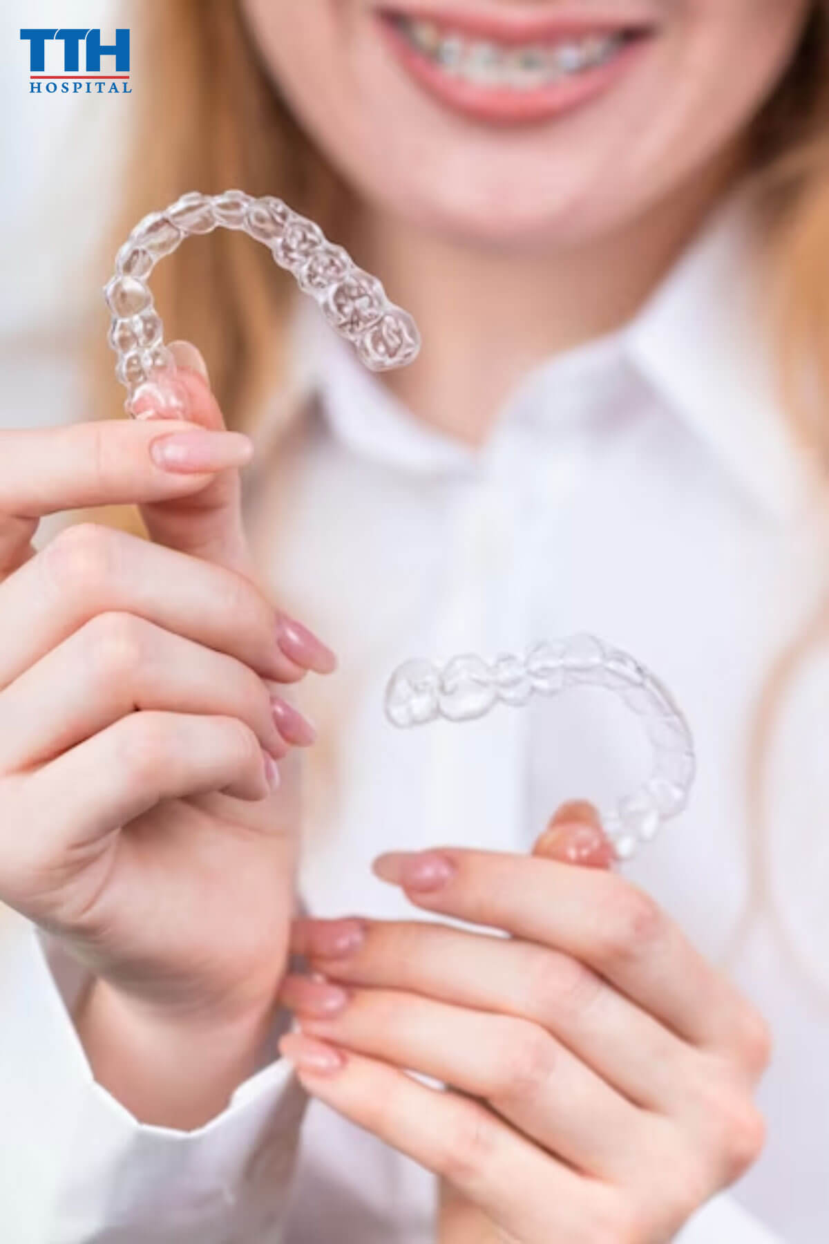 Trường hợp nào nên niềng răng Invisalign