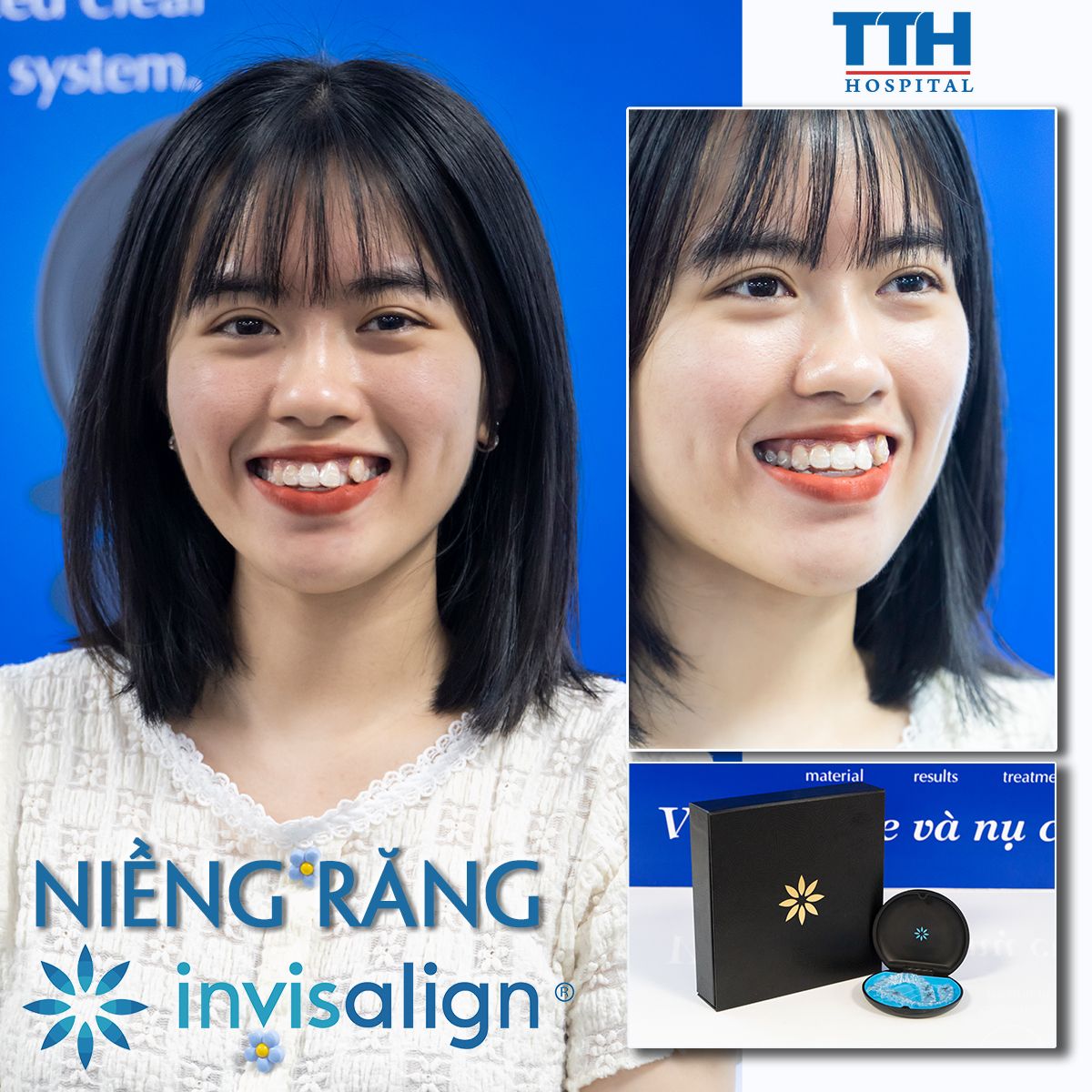  TUẦN VÀNG NIỀNG RĂNG INVISALIGN T11 2023