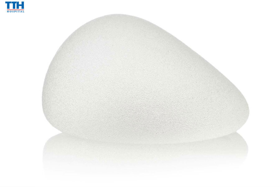 Túi ngực Mentor Memory Shape