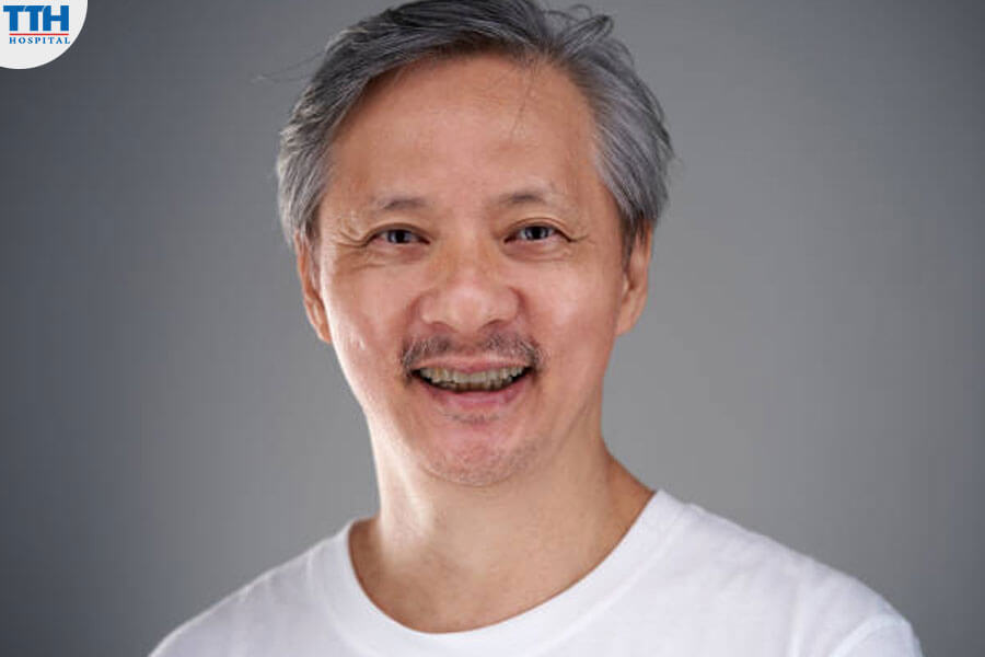 Tướng Đàn Ông có Răng Xám Đen