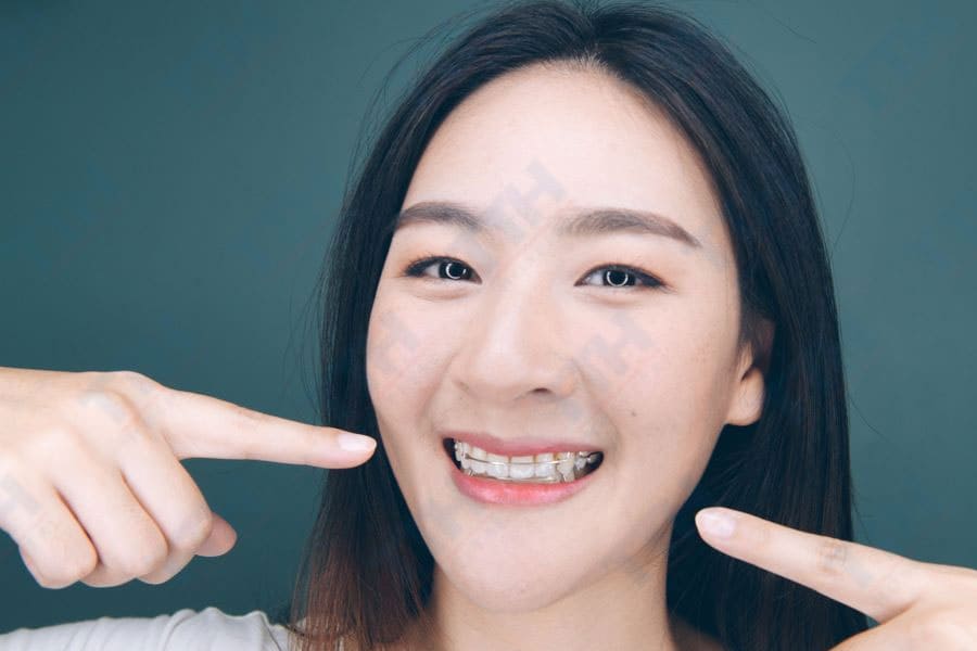 Ứng dụng trong các phương pháp điều trị chỉnh nha