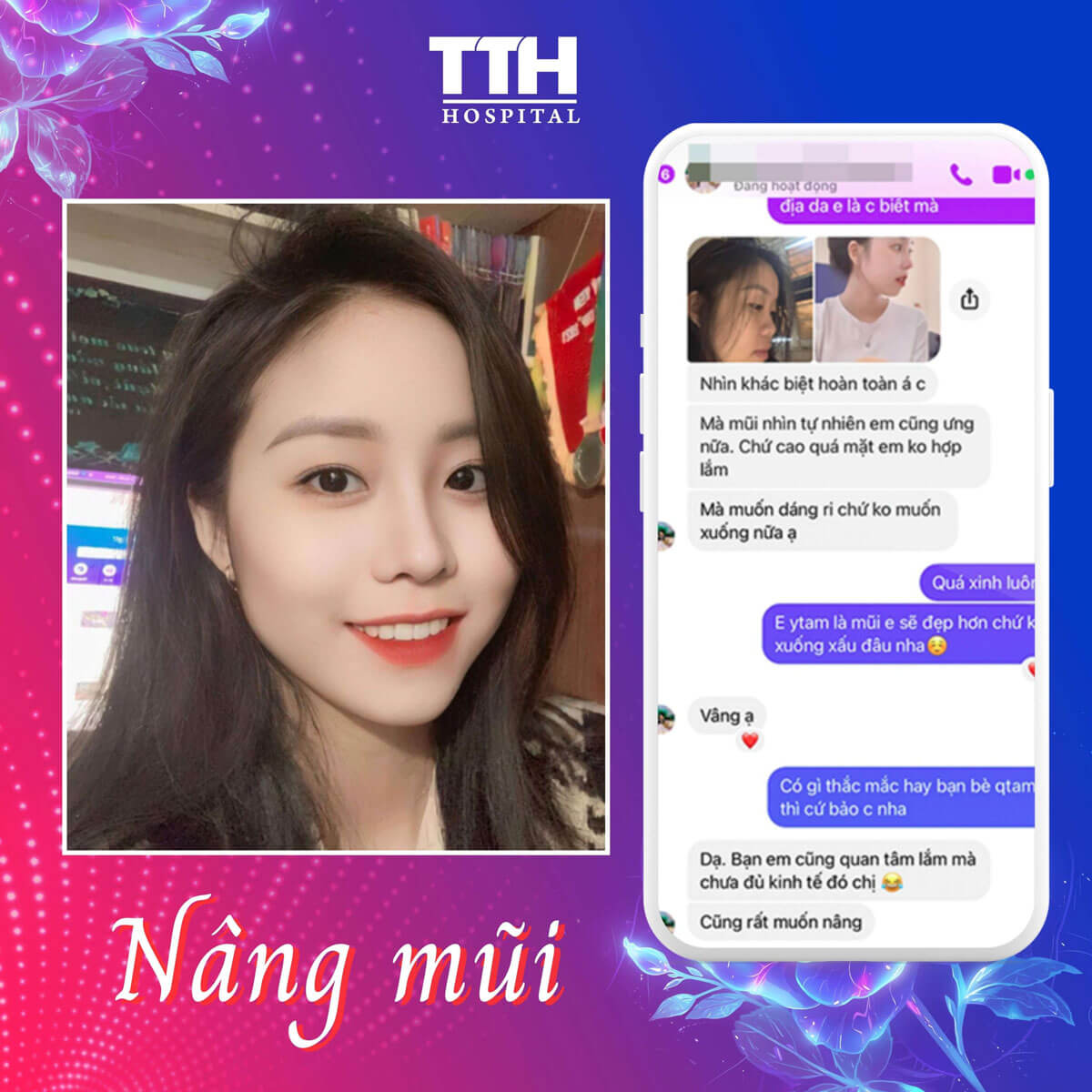 Ưu đãi nâng mũi Tuần vàng thẩm mỹ - Quyền năng phái đẹp 15-22/10/2023