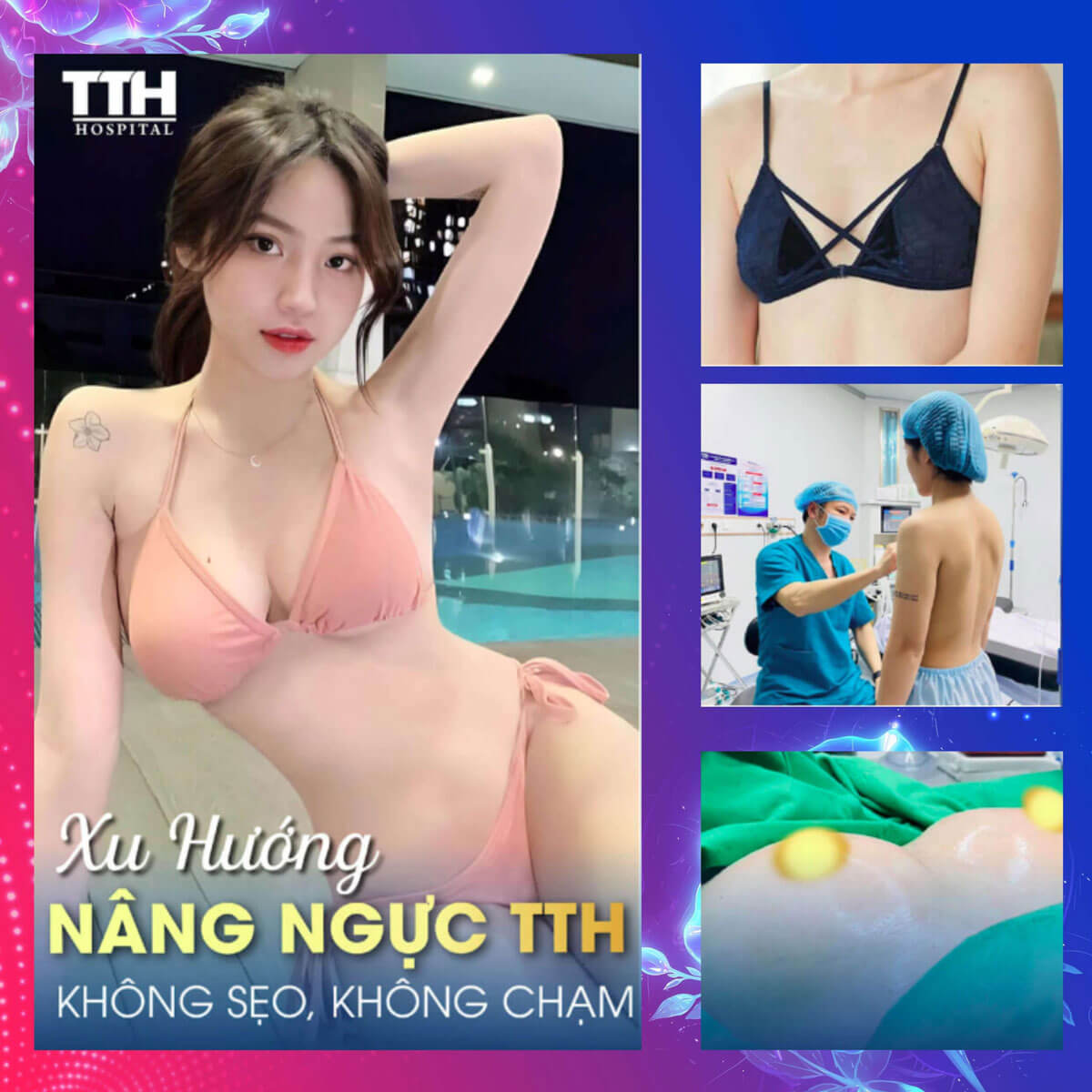 Ưu đãi nâng ngực Tuần vàng thẩm mỹ - Quyền năng phái đẹp 15-22/10/2023