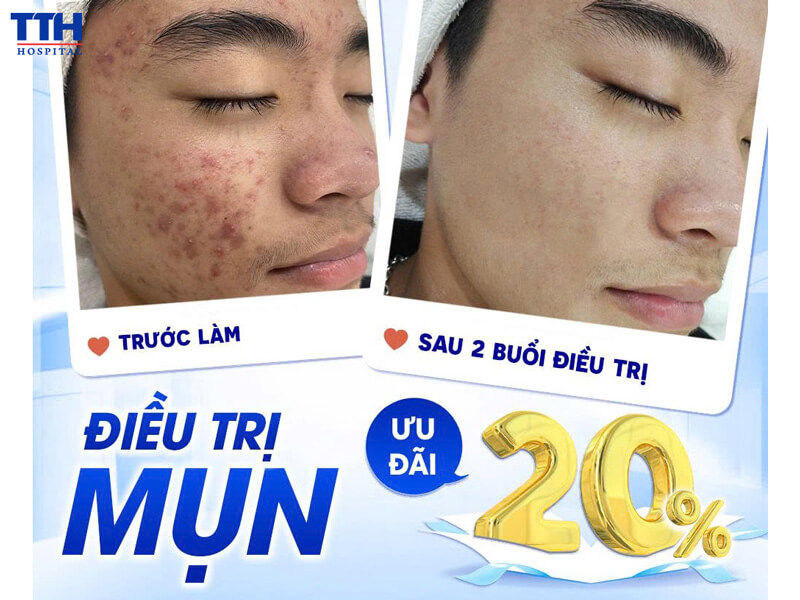 ƯU ĐÃI SIÊU HOT DÀNH RIÊNG CHO CHỊ EM
