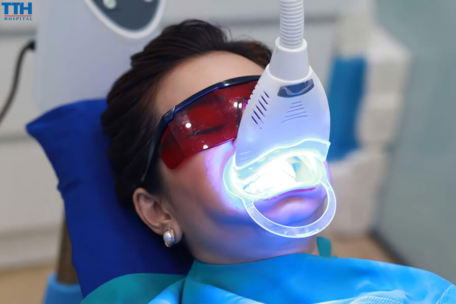 Ưu Điểm Của Công Nghệ Tẩy Trắng Răng Cold Light Lazer