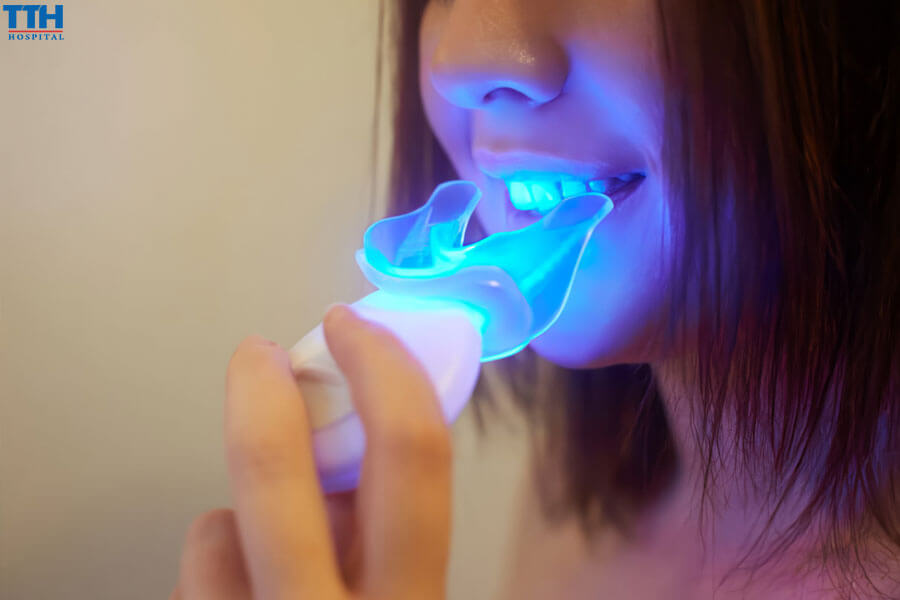 Ưu Điểm Của Công Nghệ Tẩy Trắng Răng Tại Bệnh Viện Thái Thượng Hoàng