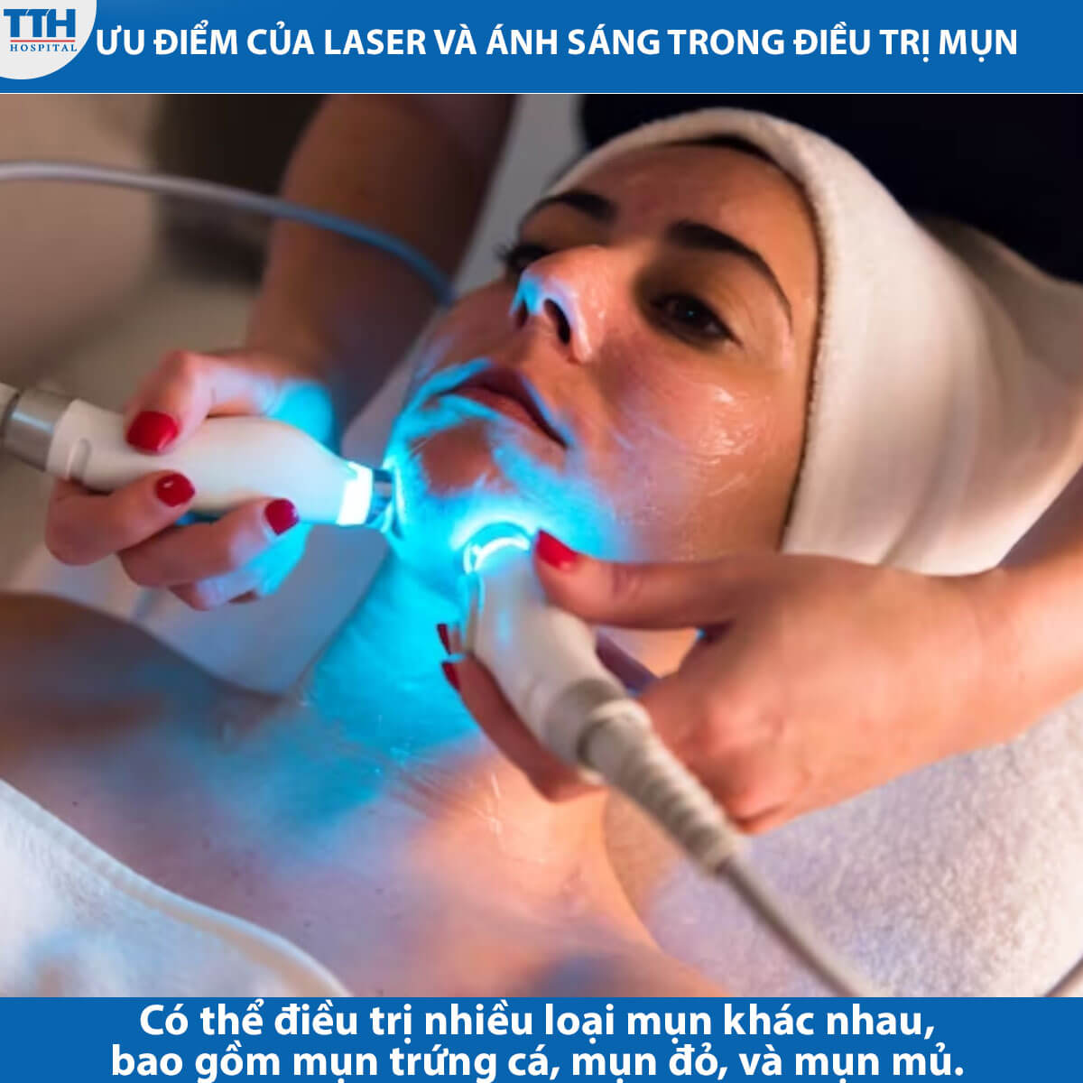 ưu điểm của laser và ánh sáng trong điều trị mụn
