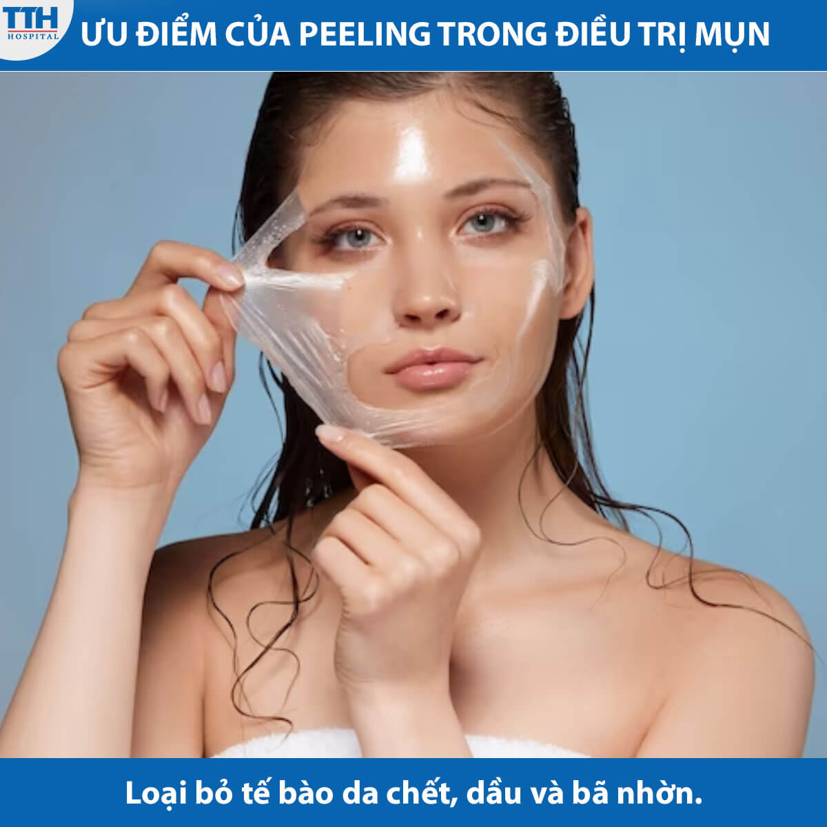 Ưu điểm của Peeling trong điều trị mụn