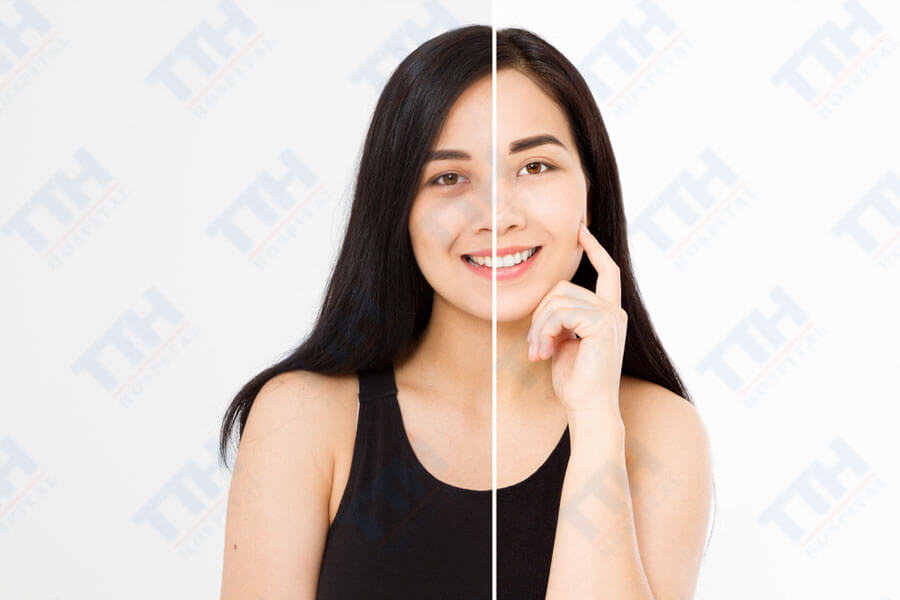Ưu điểm của tiêm BAP so với các phương pháp thẩm mỹ khác
