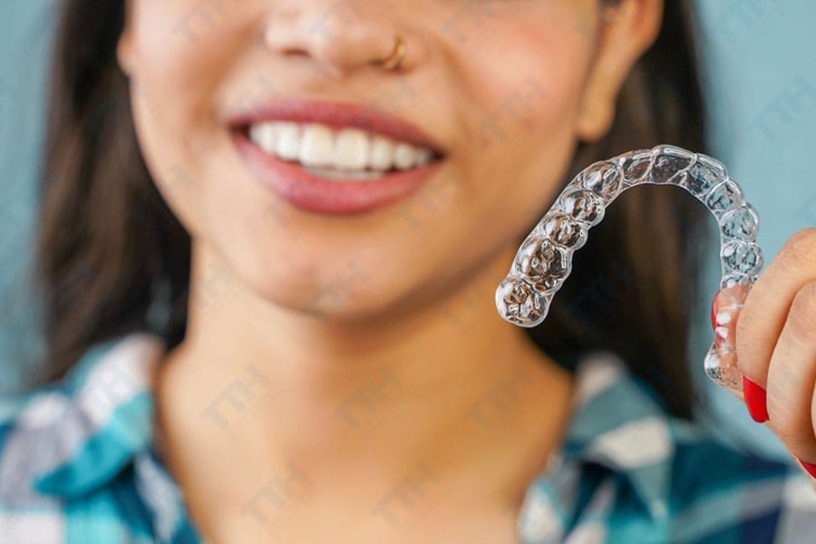 Ưu Điểm Và Hạn Chế Của Niềng Invisalign 1 Hàm