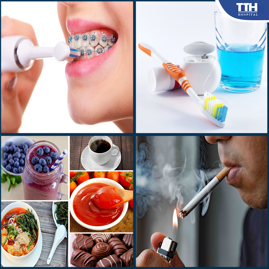 Thường xuyên vệ sinh răng miệng, sử dụng chỉ nha khoa, hạn chế thực phẩm gây nhiễm màu và tránh hút thuốc lá sẽ giúp giữ cho mắc cài sứ không bị đổi màu