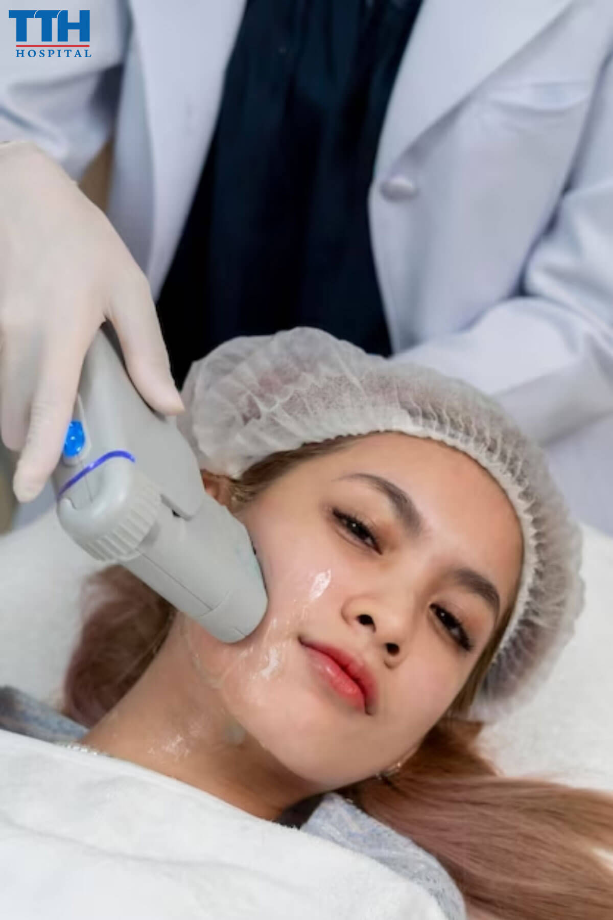 Yếu tố ảnh hưởng đến thời gian điều trị nám bằng laser trị nám tại Vinh, Nghệ An