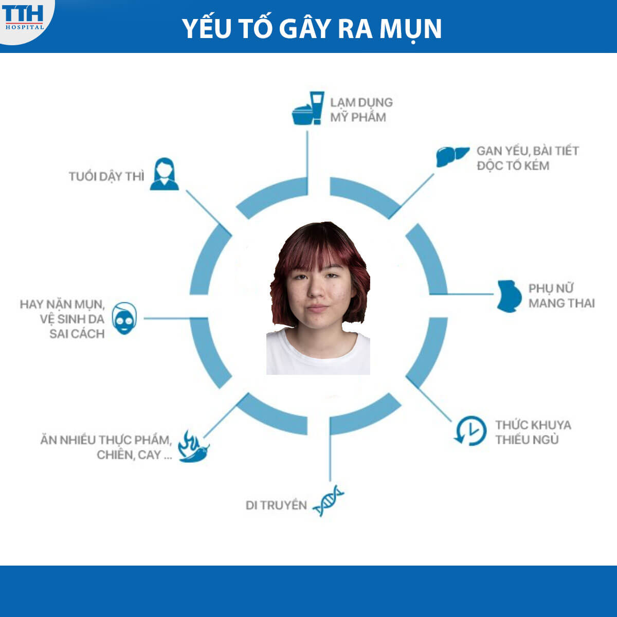 Yếu tố gây ra mụn
