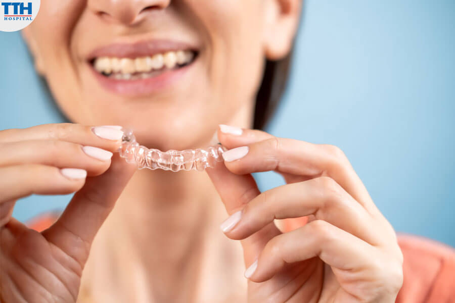 Yếu Tố Nào Ảnh Hưởng Đến Thời Gian Niềng Răng Invisalign