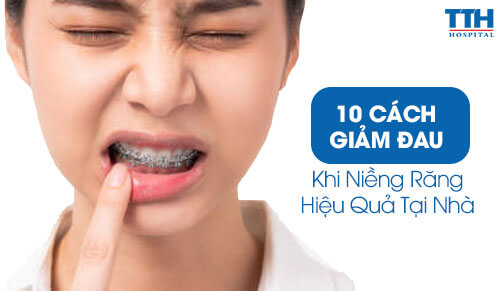 10 Cách Giảm Đau Khi Niềng Răng Hiệu Quả Tại Nhà