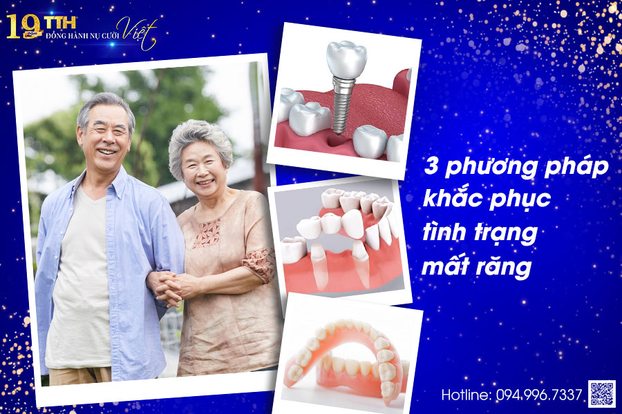 3 phương pháp khắc phục tình trạng mất răng