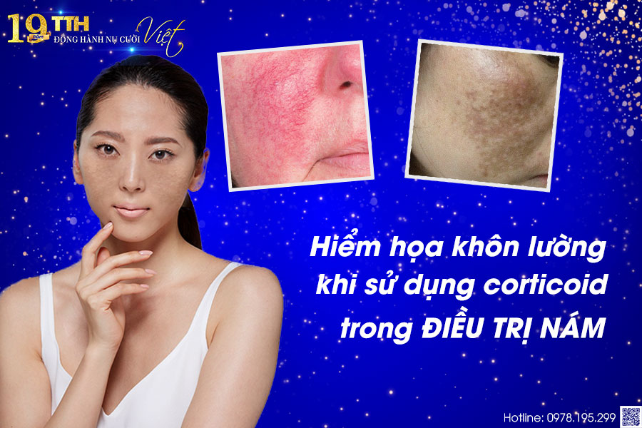Hiểm họa khôn lường khi sử dụng corticoid trong điều trị nám