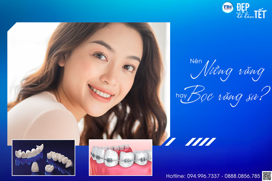 Nên niềng răng hay bọc răng sứ?