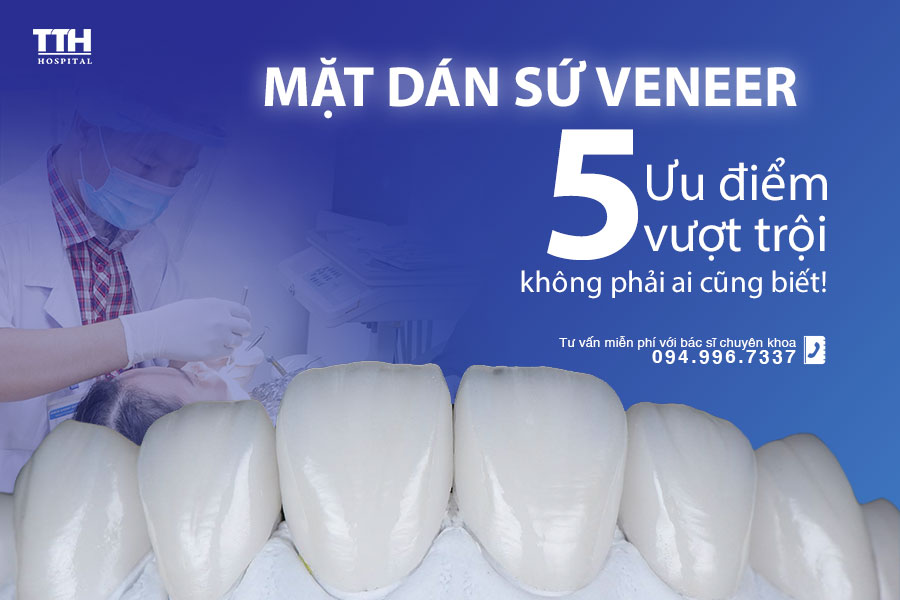 Mặt dán sứ Veneer và 5 ưu điểm vượt trội không phải ai cũng biết