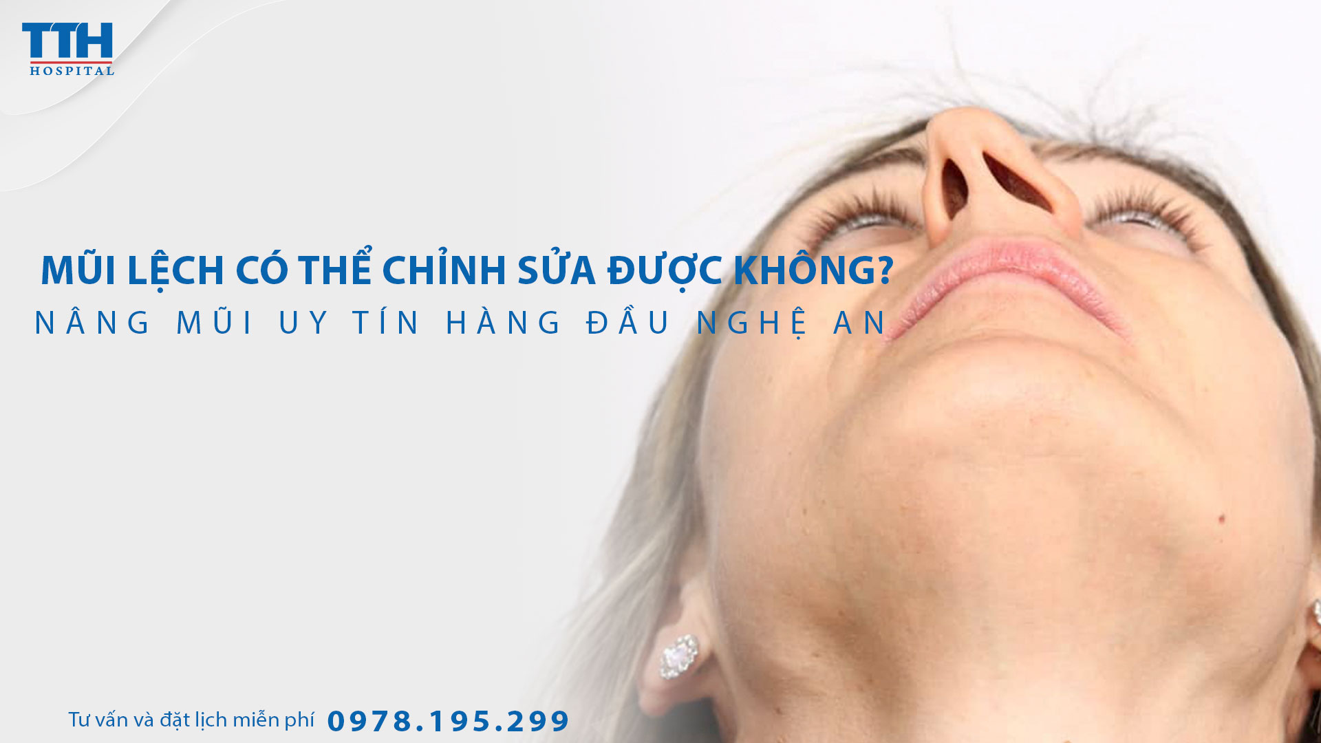 Mũi lệch có thể chỉnh sửa được không? Nâng mũi uy tín hàng đầu Nghệ An, Hà Tĩnh tại Bệnh viện Thái Thượng Hoàng