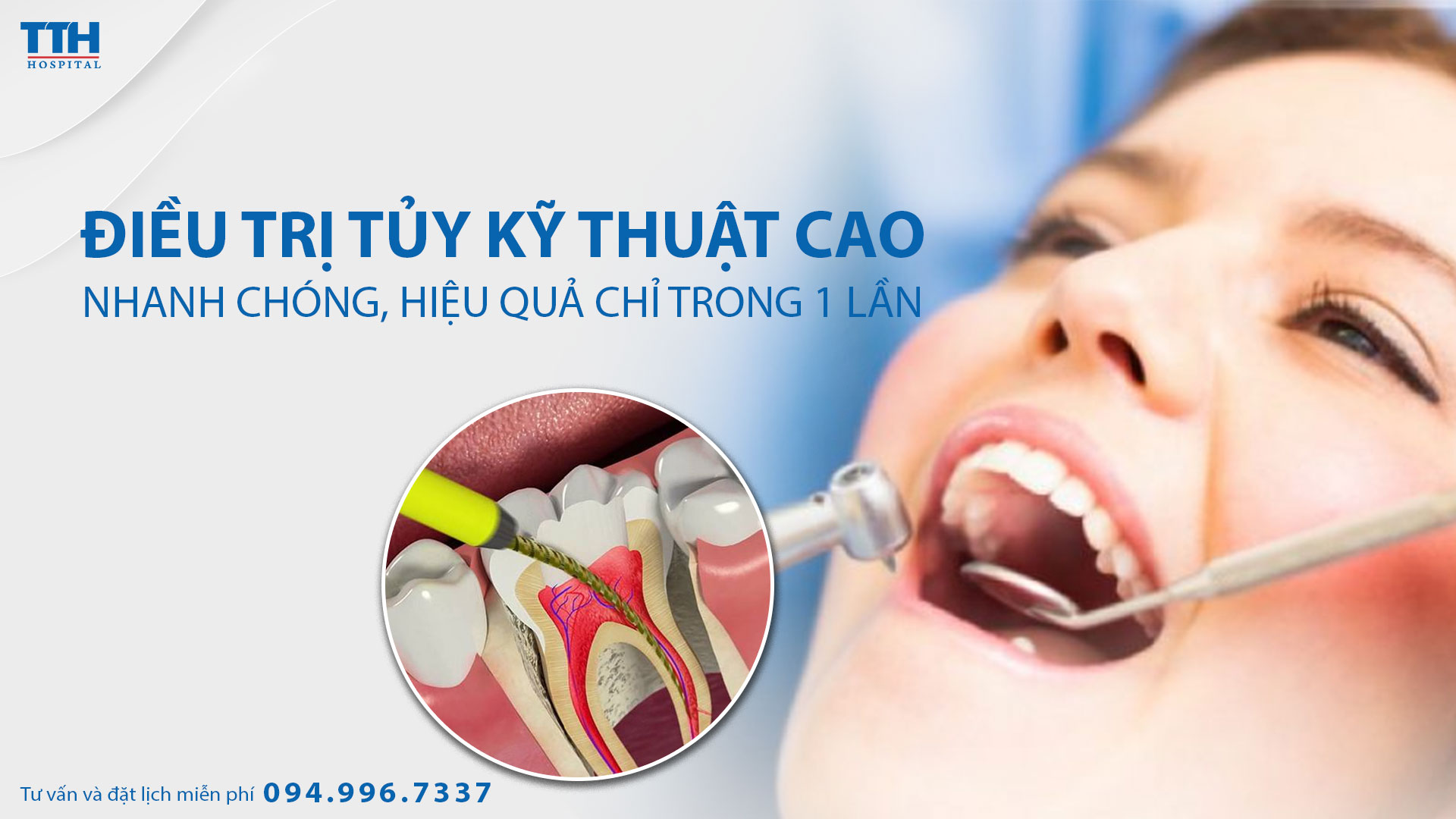 Điều trị tủy răng hiệu quả chỉ trong 1 lần hẹn tại Bệnh viện Thái Thượng Hoàng