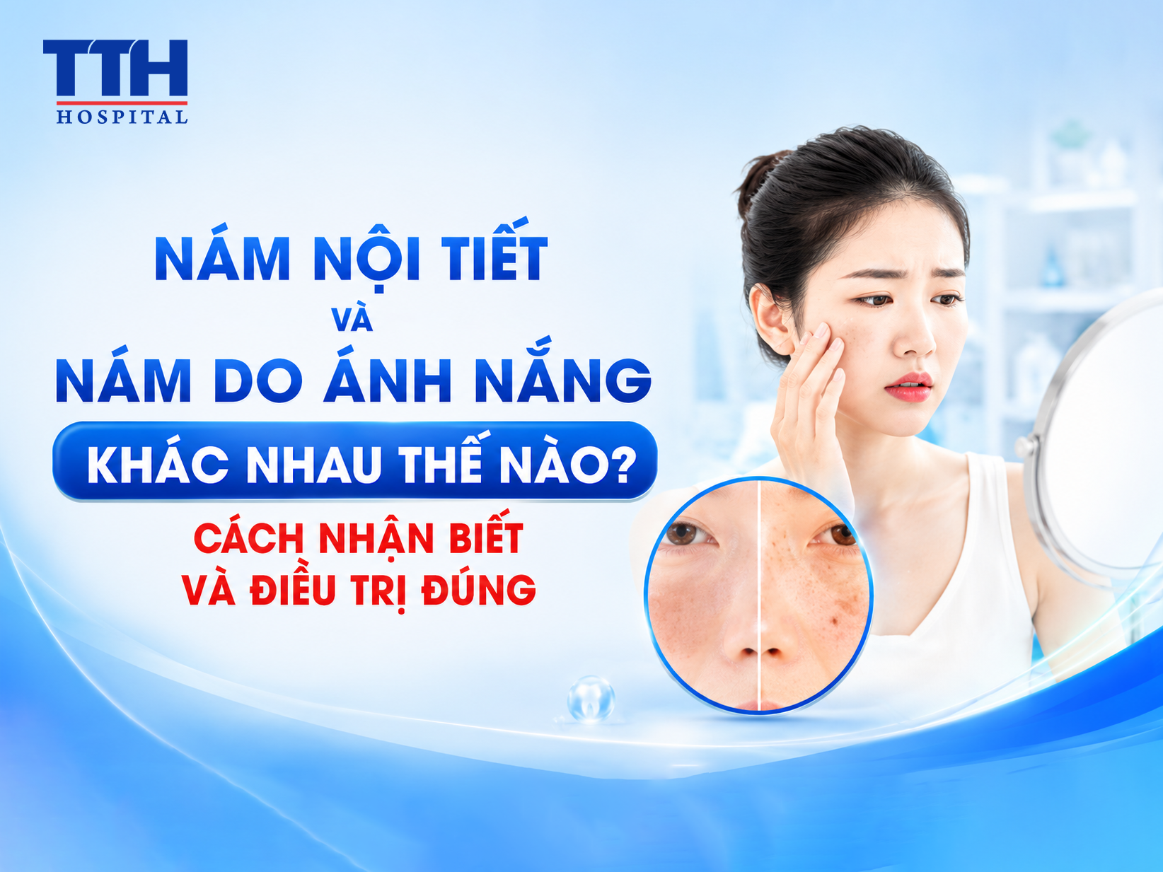 NÁM NỘI TIẾT VÀ NÁM DO ÁNH NẮNG KHÁC NHAU THẾ NÀO? CÁCH NHẬN BIẾT VÀ ĐIỀU TRỊ ĐÚNG
