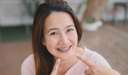 40 tuổi có thể niềng răng hay không?