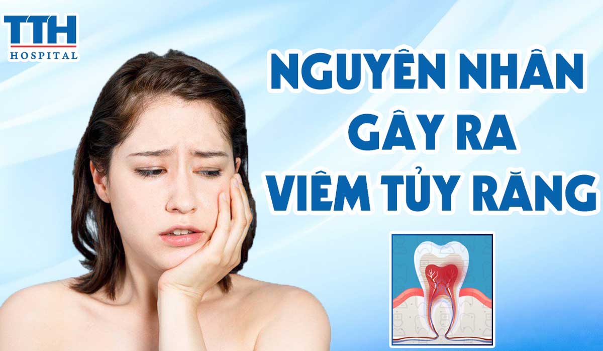 Nguyên nhân gây ra viêm tủy răng