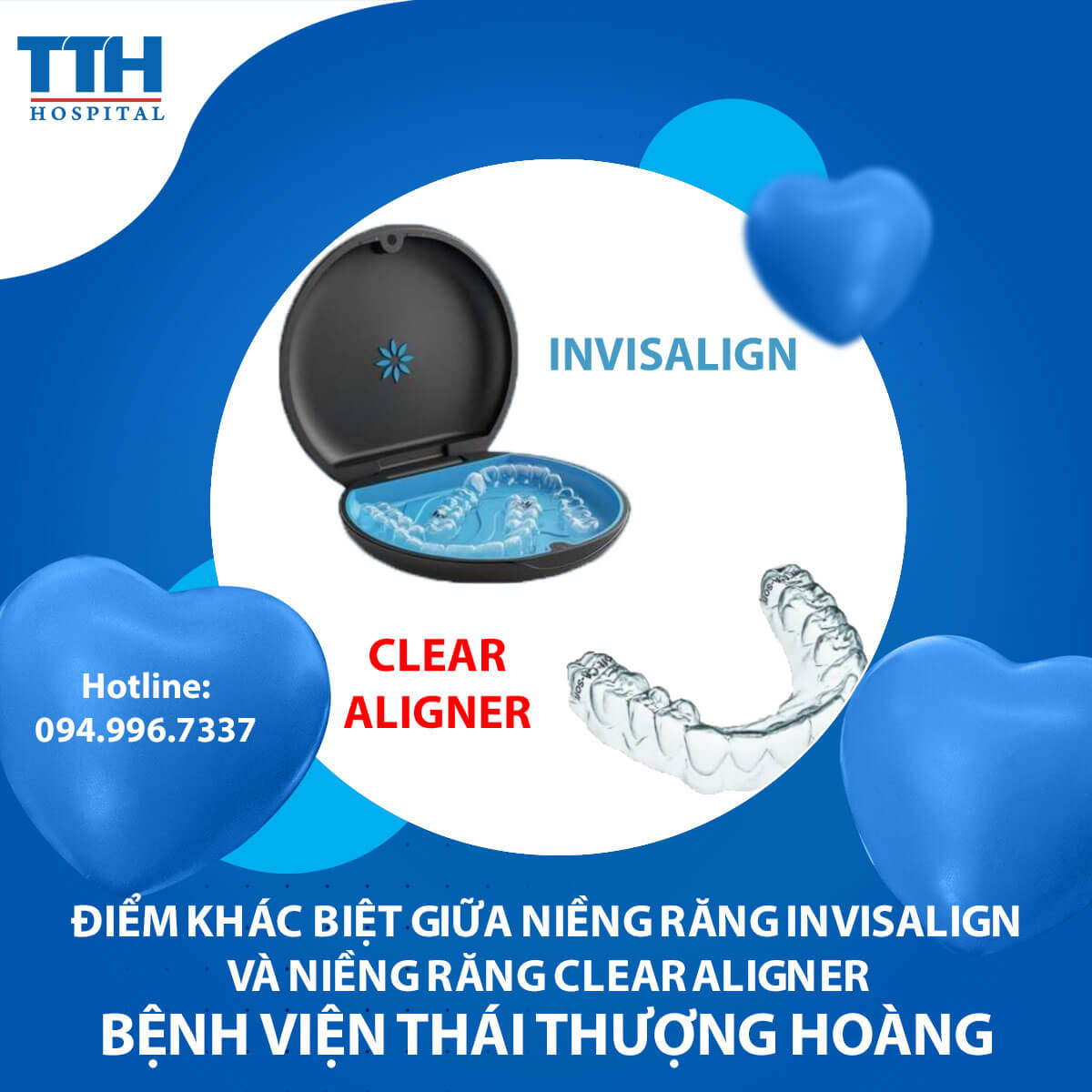 Điểm khác biệt giữa niềng răng Invisalign và niềng răng Clear Aligner