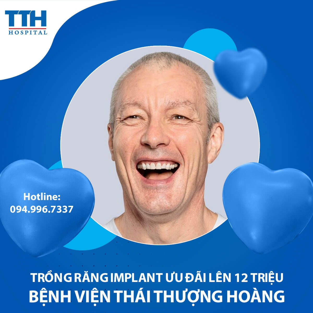 Tuần vàng ưu đãi trồng răng Implant