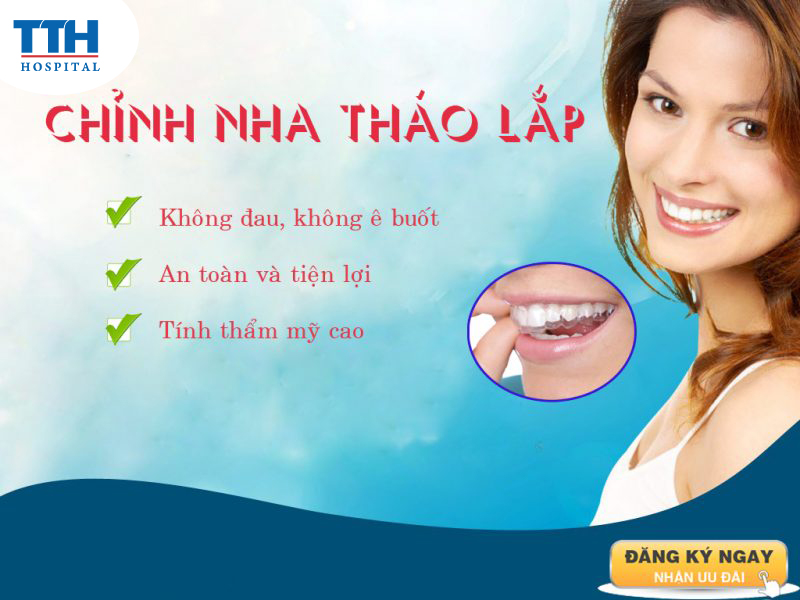 Chỉnh nha tháo lắp