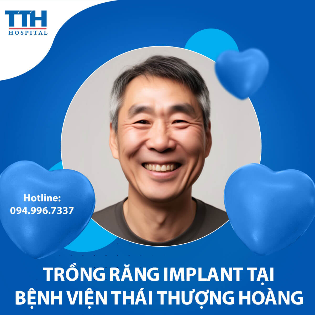 Trường hợp nào nên trồng răng implant?
