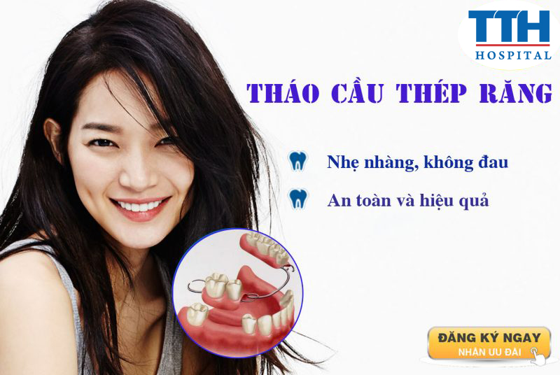 Phương pháp tháo cầu thép răng
