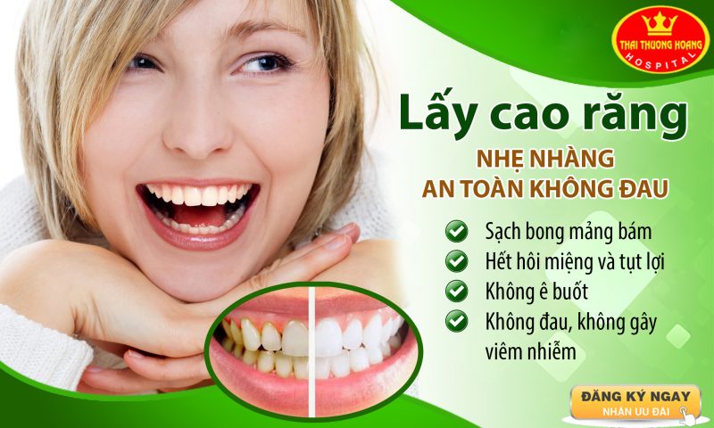 Lấy cao răng