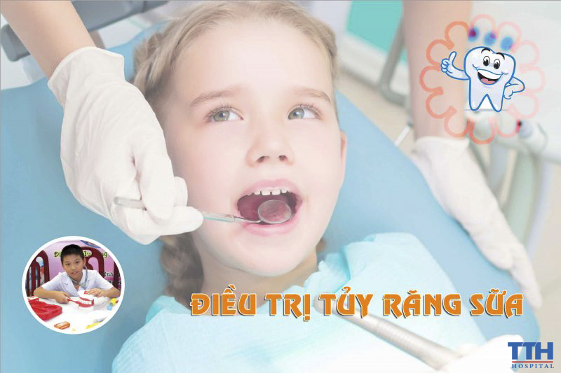 Điều trị tủy răng sữa