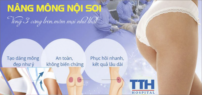 Nâng mông