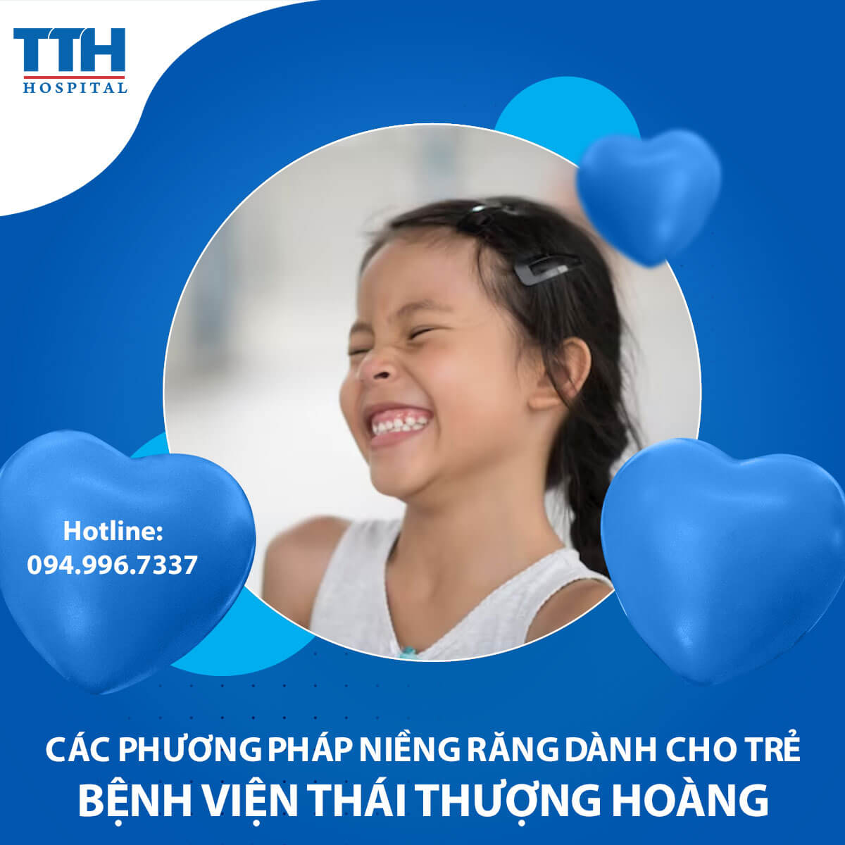 Các phương pháp niềng răng dành cho trẻ