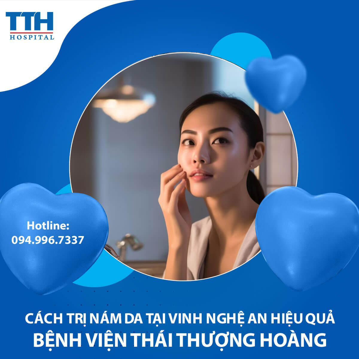 Cách Trị Nám da Tại Vinh Nghệ An Hiệu Quả