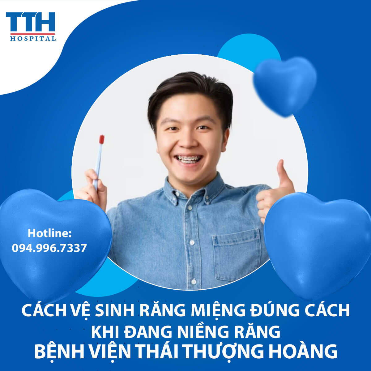 Cách Vệ Sinh Răng Miệng Đúng Cách Khi Đang Niềng Răng